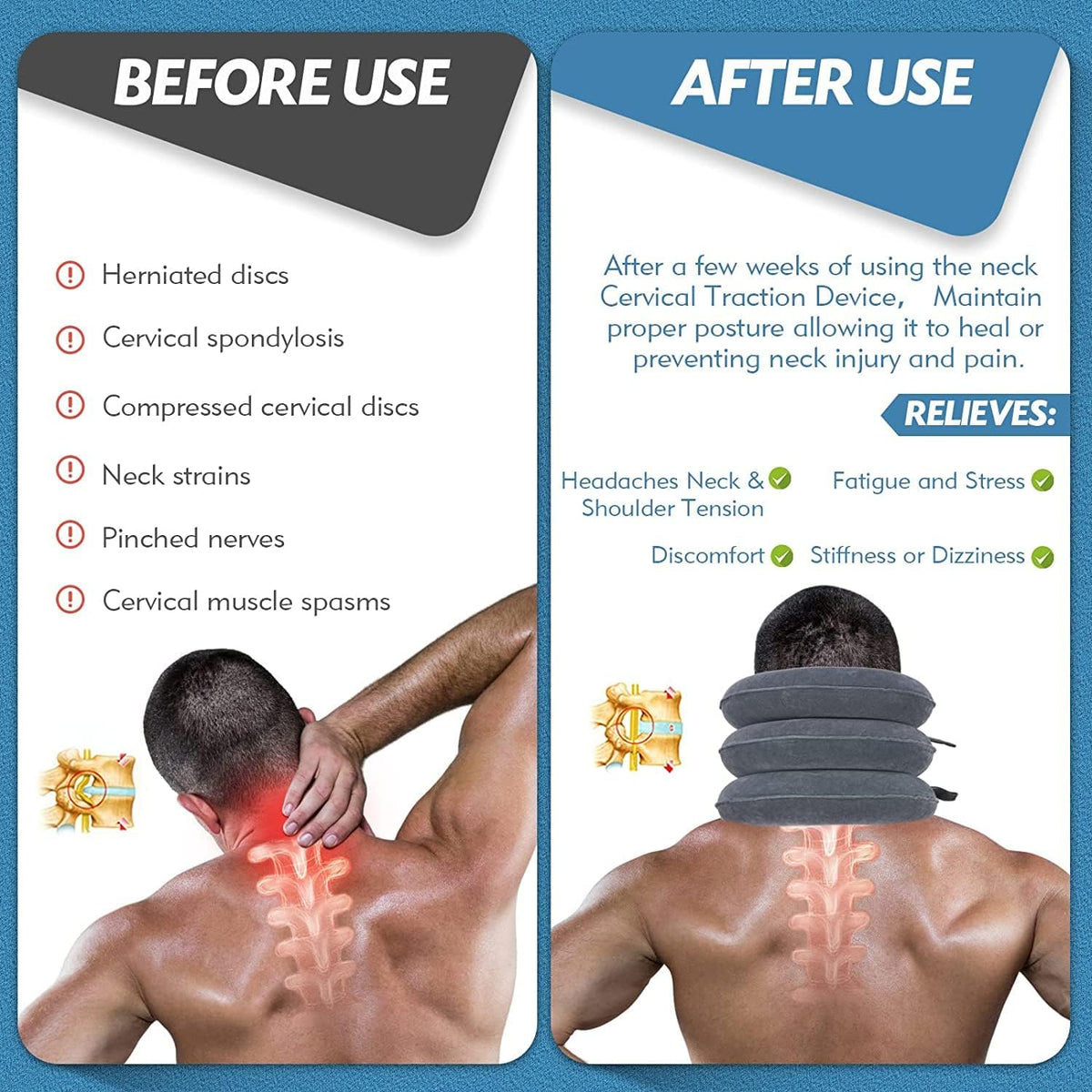 Before and after panel showing the change in neck posture with the traction device.