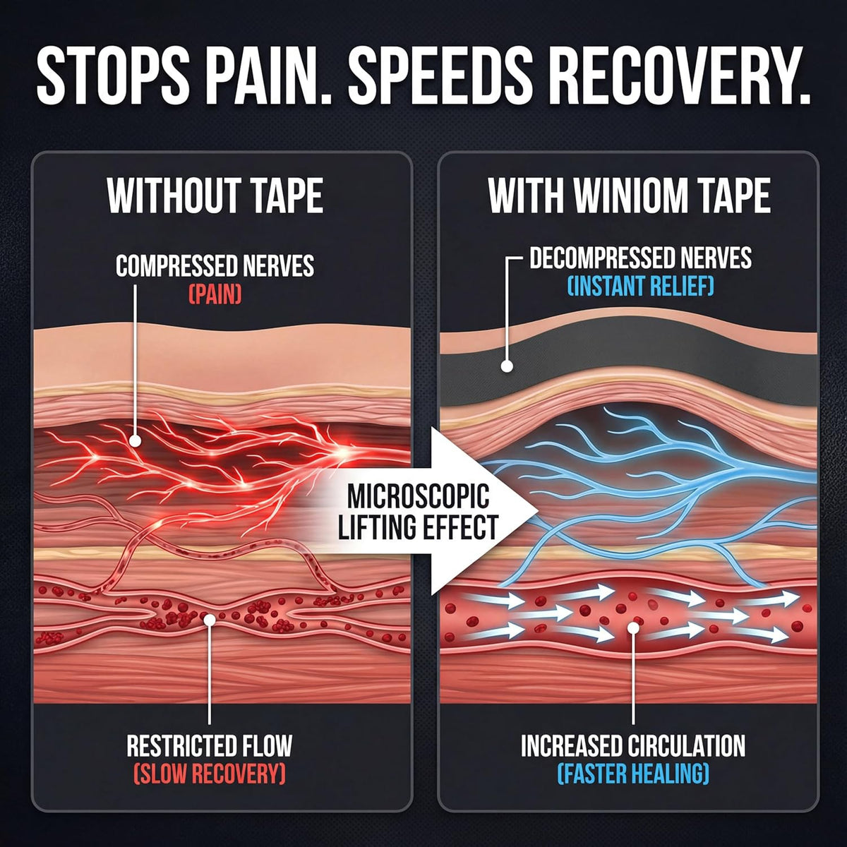 Kinesiology tape application areas